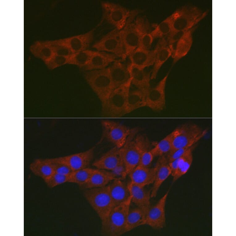 Immunofluorescence - Anti-WNK3 Antibody (A88624) - Antibodies.com