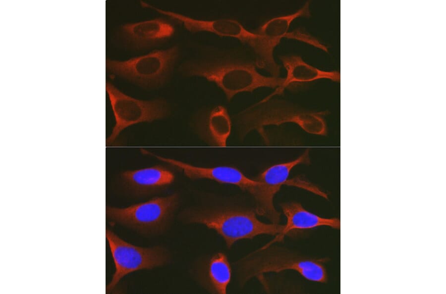 Immunofluorescence - Anti-WNK3 Antibody (A88624) - Antibodies.com