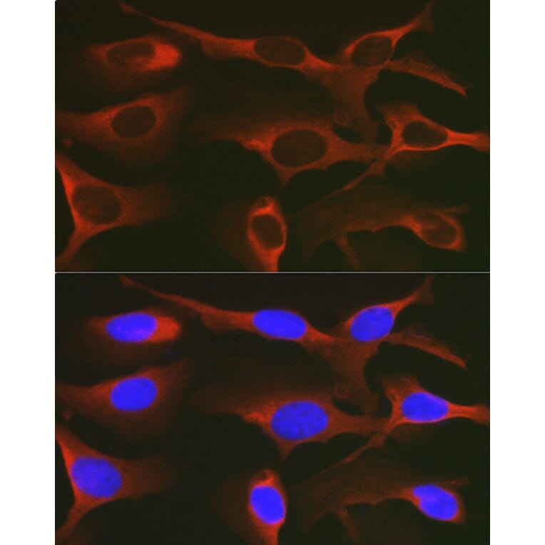 Immunofluorescence - Anti-WNK3 Antibody (A88624) - Antibodies.com