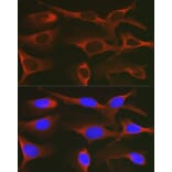 Immunofluorescence - Anti-WNK3 Antibody (A88624) - Antibodies.com