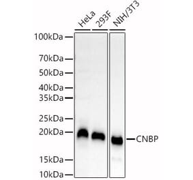 Western Blot - Anti-CNBP Antibody (A88625) - Antibodies.com