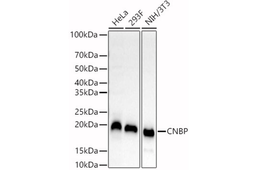 Western Blot - Anti-CNBP Antibody (A88625) - Antibodies.com