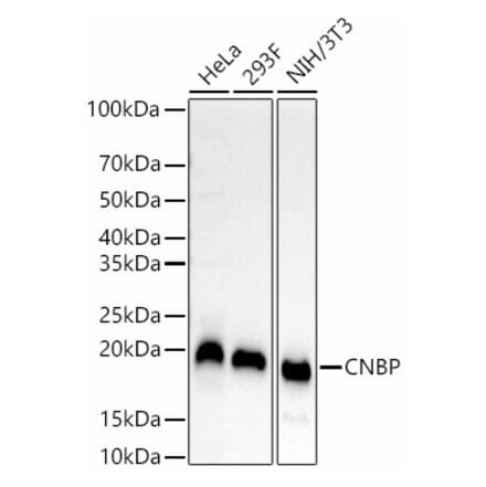 Western Blot - Anti-CNBP Antibody (A88625) - Antibodies.com