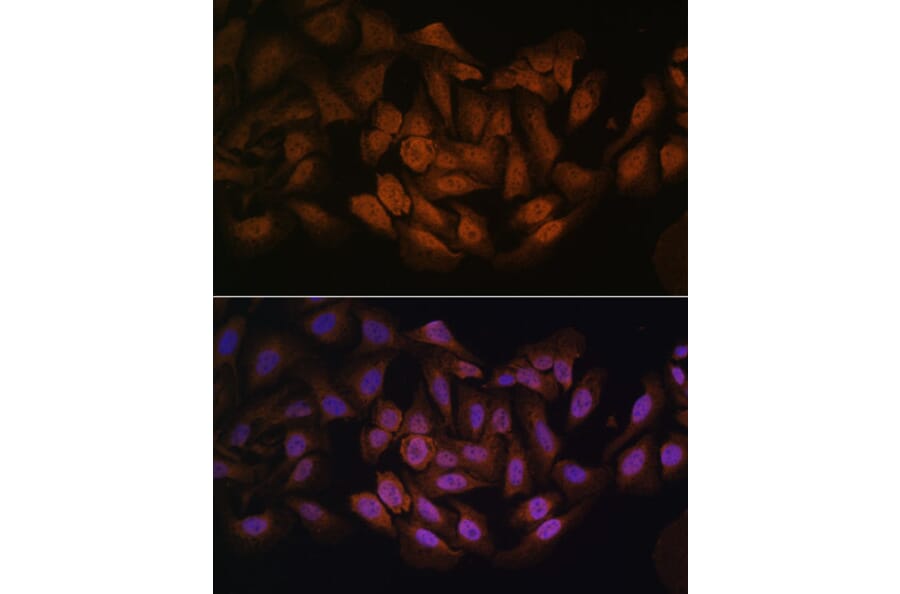 Immunofluorescence - Anti-CNBP Antibody (A88625) - Antibodies.com