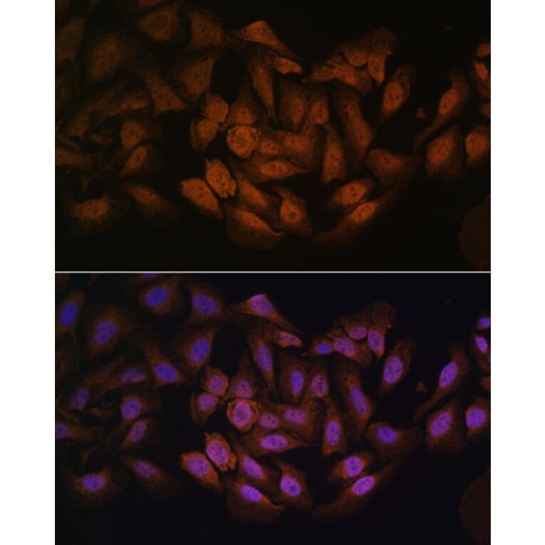 Immunofluorescence - Anti-CNBP Antibody (A88625) - Antibodies.com