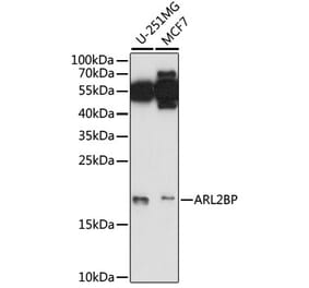 Western Blot - Anti-ARL2BP Antibody (A88626) - Antibodies.com