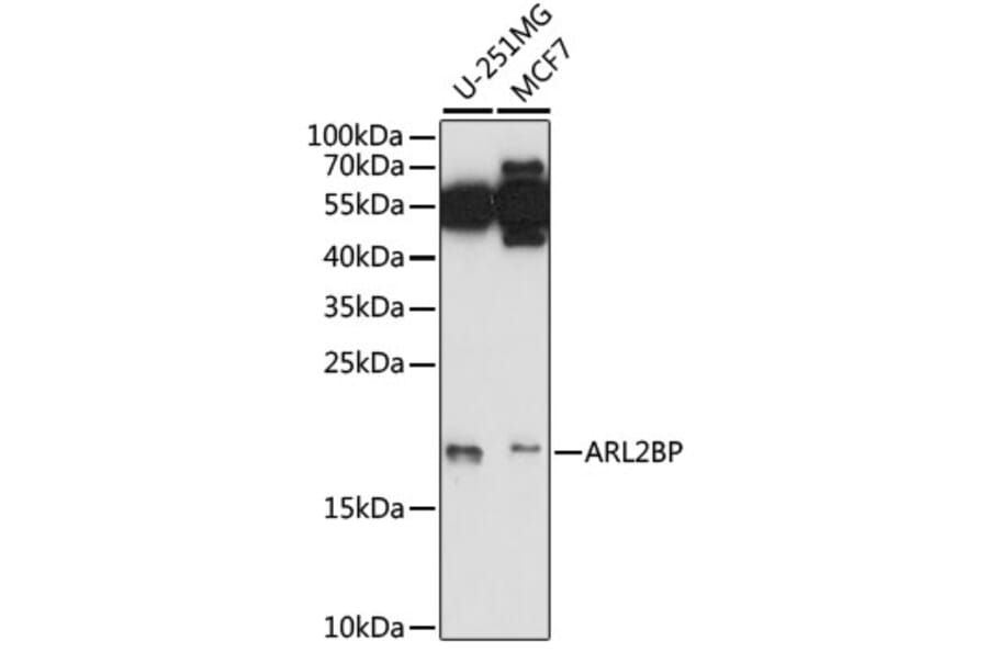 Western Blot - Anti-ARL2BP Antibody (A88626) - Antibodies.com