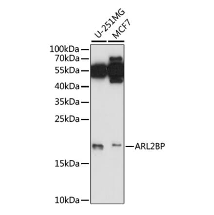 Western Blot - Anti-ARL2BP Antibody (A88626) - Antibodies.com