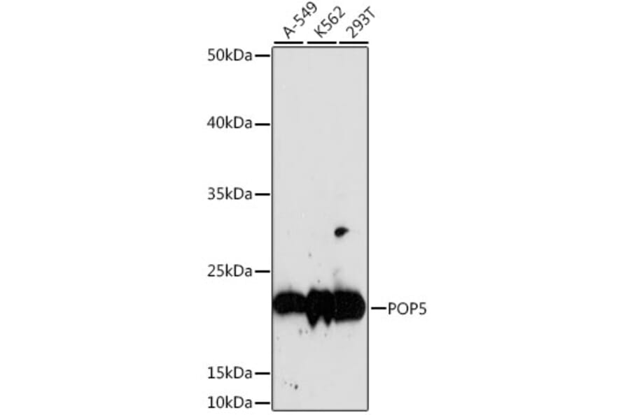 Western Blot - Anti-POP5 Antibody (A88627) - Antibodies.com