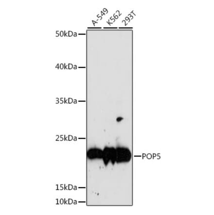 Western Blot - Anti-POP5 Antibody (A88627) - Antibodies.com
