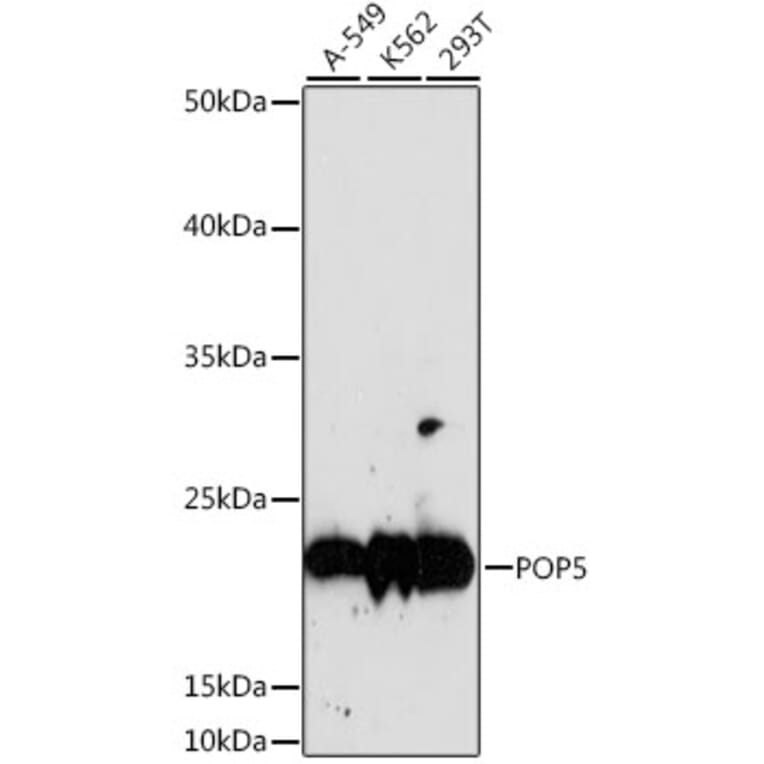 Western Blot - Anti-POP5 Antibody (A88627) - Antibodies.com