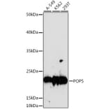 Western Blot - Anti-POP5 Antibody (A88627) - Antibodies.com