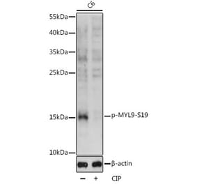 Western Blot - Anti-MYL9 (phospho Ser19) Antibody (A88628) - Antibodies.com