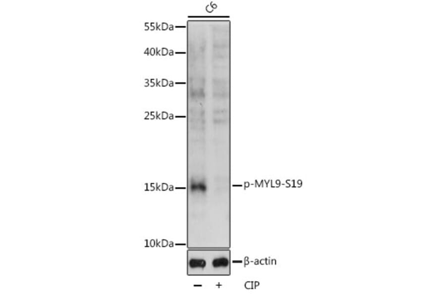 Western Blot - Anti-MYL9 (phospho Ser19) Antibody (A88628) - Antibodies.com