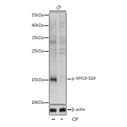 Western Blot - Anti-MYL9 (phospho Ser19) Antibody (A88628) - Antibodies.com