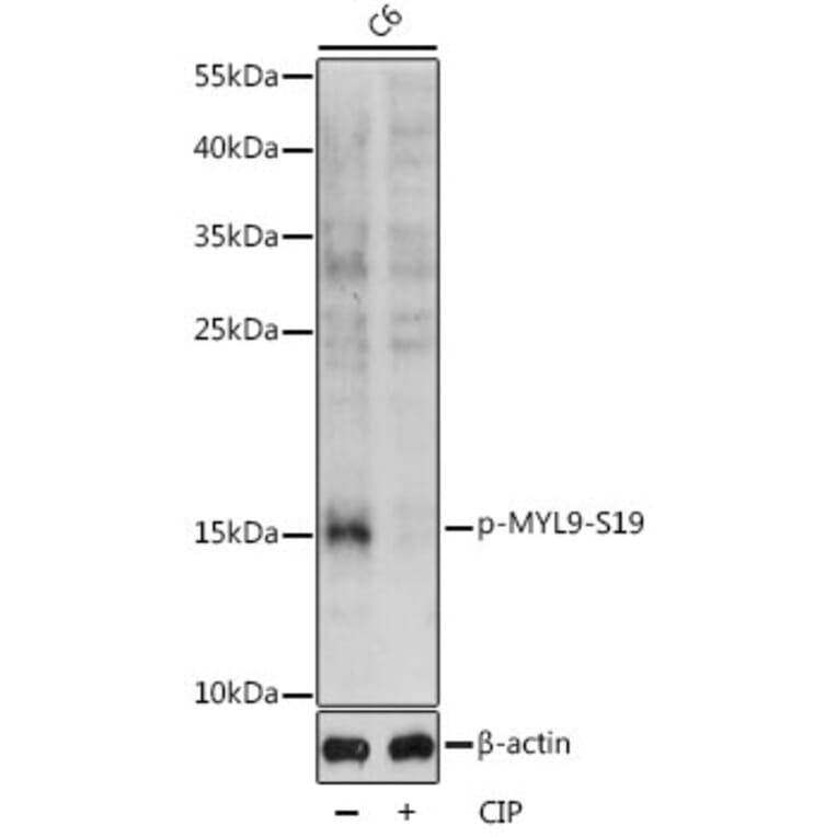 Western Blot - Anti-MYL9 (phospho Ser19) Antibody (A88628) - Antibodies.com