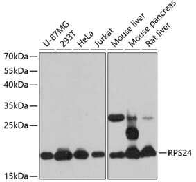 Western Blot - Anti-RPS24 Antibody (A88629) - Antibodies.com