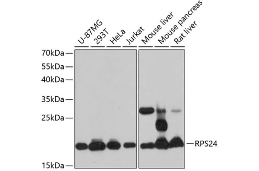 Western Blot - Anti-RPS24 Antibody (A88629) - Antibodies.com