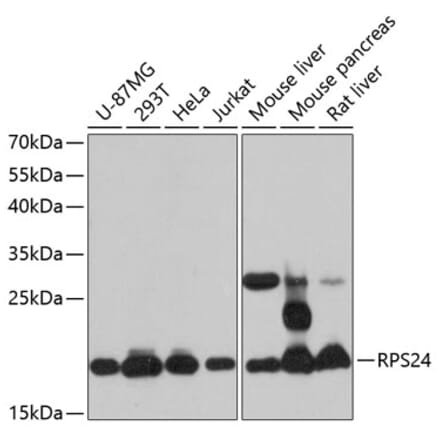 Western Blot - Anti-RPS24 Antibody (A88629) - Antibodies.com