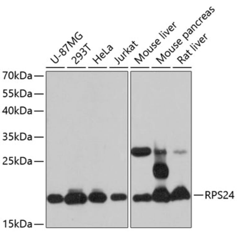 Western Blot - Anti-RPS24 Antibody (A88629) - Antibodies.com