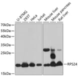 Western Blot - Anti-RPS24 Antibody (A88629) - Antibodies.com