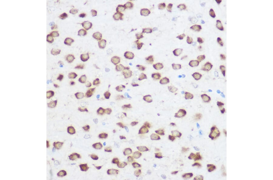 Immunohistochemistry - Anti-RPS24 Antibody (A88629) - Antibodies.com