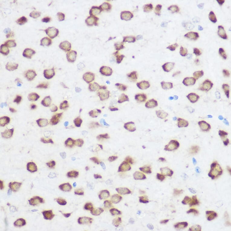 Immunohistochemistry - Anti-RPS24 Antibody (A88629) - Antibodies.com