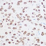 Immunohistochemistry - Anti-RPS24 Antibody (A88629) - Antibodies.com
