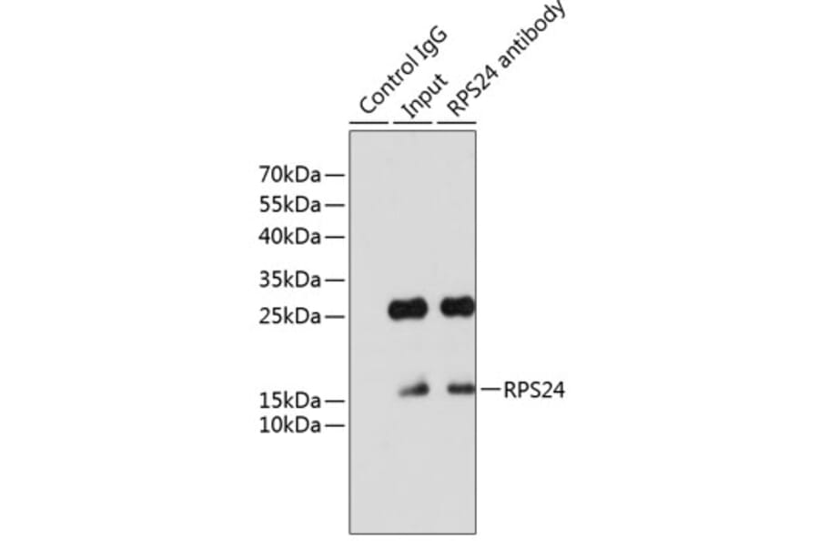 Western Blot - Anti-RPS24 Antibody (A88629) - Antibodies.com