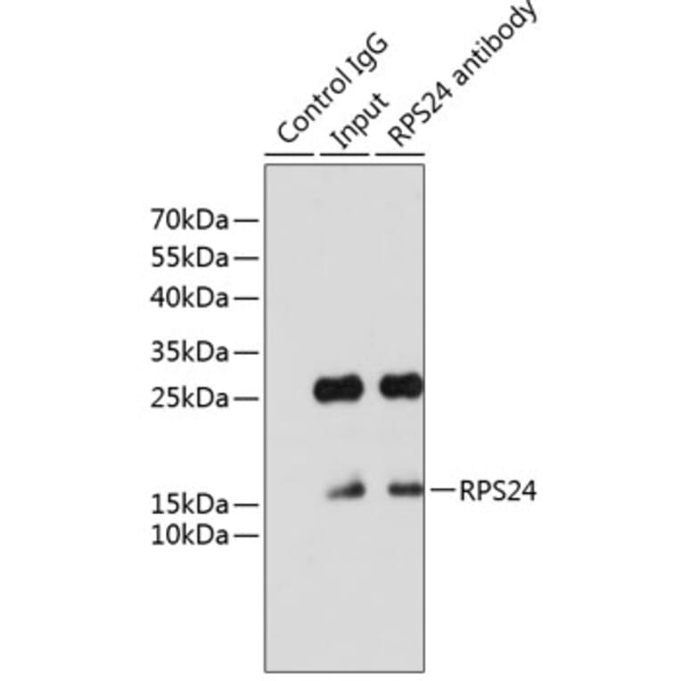 Western Blot - Anti-RPS24 Antibody (A88629) - Antibodies.com