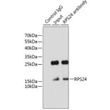 Western Blot - Anti-RPS24 Antibody (A88629) - Antibodies.com