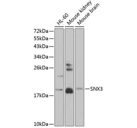 Western Blot - Anti-SNX3 Antibody (A88630) - Antibodies.com