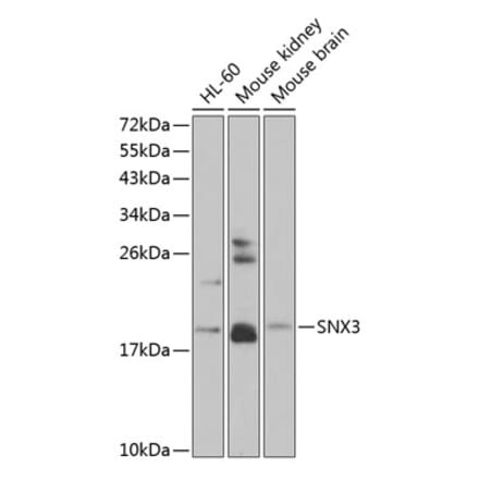 Western Blot - Anti-SNX3 Antibody (A88630) - Antibodies.com