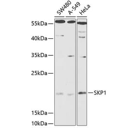 Western Blot - Anti-Skp1 Antibody (A88631) - Antibodies.com