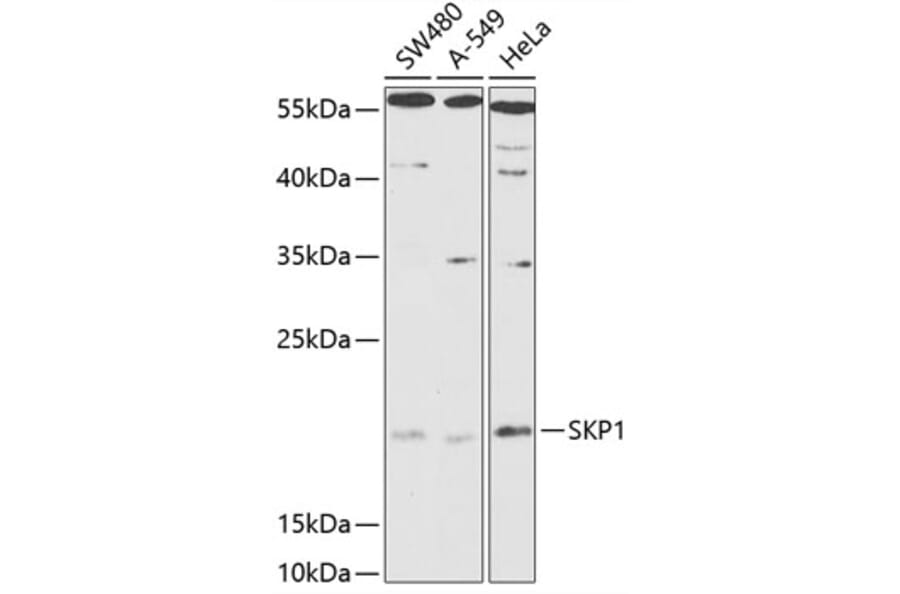 Western Blot - Anti-Skp1 Antibody (A88631) - Antibodies.com
