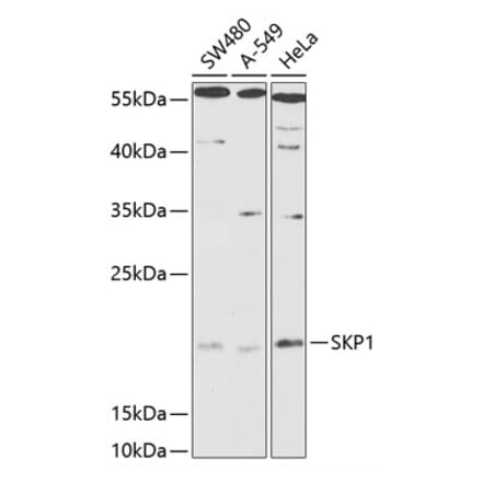 Western Blot - Anti-Skp1 Antibody (A88631) - Antibodies.com