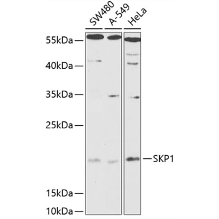 Western Blot - Anti-Skp1 Antibody (A88631) - Antibodies.com