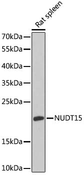 Western blot analysis of extracts of mouse spleen, using Anti-NUDT15 Antibody (A14141) at 1:1,000 dilution.
Secondary antibody: Goat Anti-Rabbit IgG (H+L) (HRP) (AS014) at 1:10,000 dilution.
Lysates / proteins: 25µg per lane.
Blocking buffer: 3% non-fat dry milk in TBST.
Detection: ECL Basic Kit (RM00020).
Exposure time: 60s.