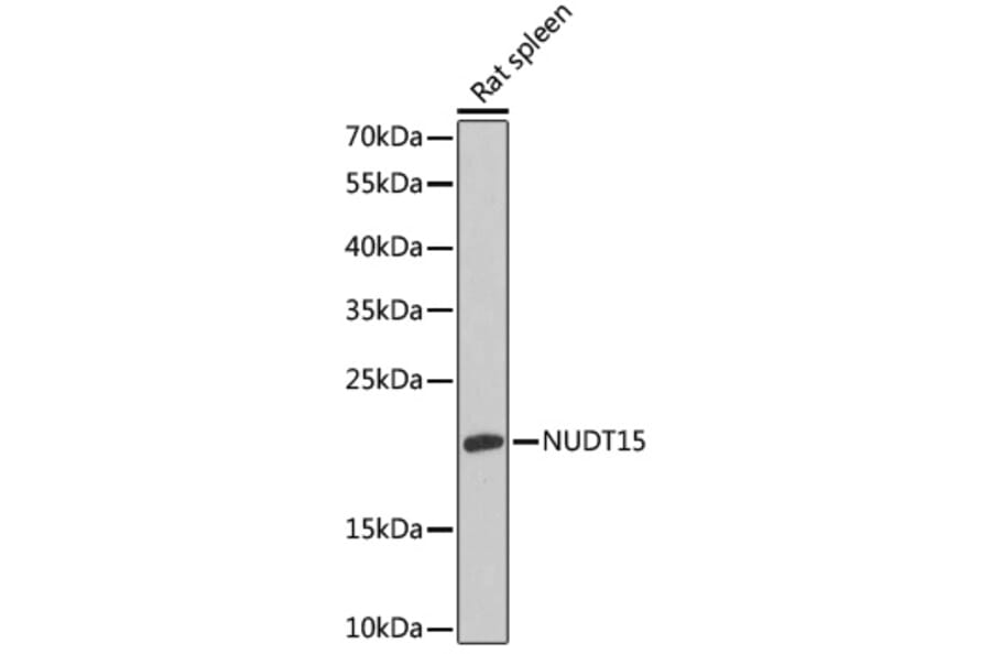 Western Blot - Anti-NUDT15 Antibody (A88632) - Antibodies.com