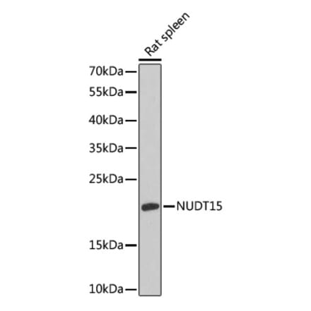 Western Blot - Anti-NUDT15 Antibody (A88632) - Antibodies.com