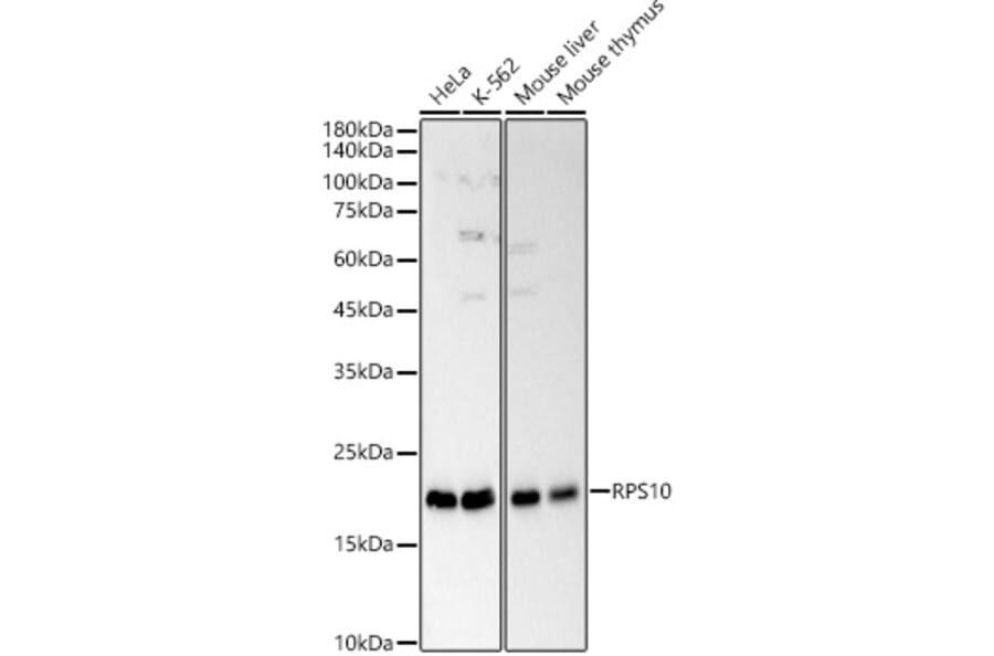 Western Blot - Anti-RPS10 Antibody (A88633) - Antibodies.com