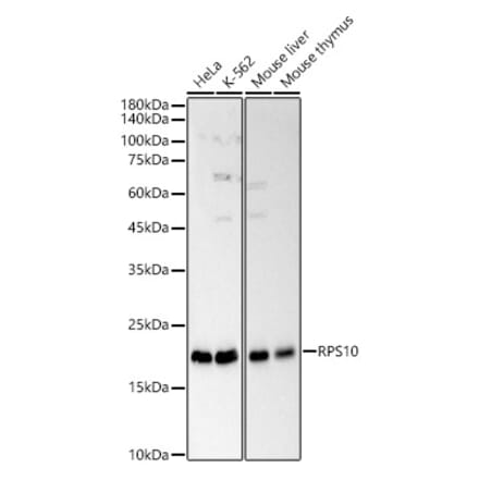 Western Blot - Anti-RPS10 Antibody (A88633) - Antibodies.com