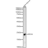 Western Blot - Anti-RPS10 Antibody (A88633) - Antibodies.com
