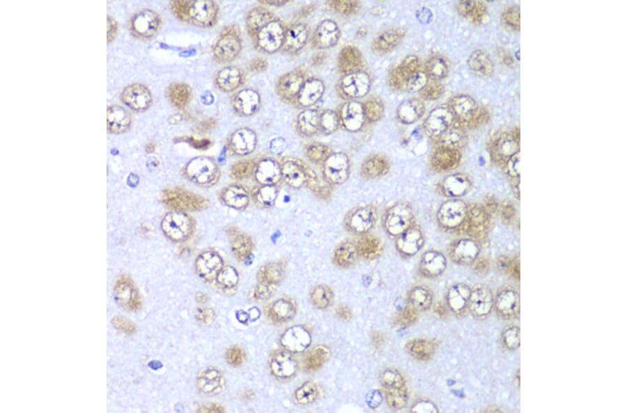 Immunohistochemistry - Anti-RPS10 Antibody (A88633) - Antibodies.com