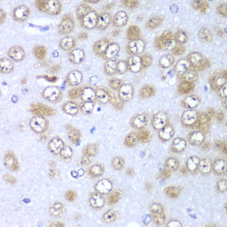 Immunohistochemistry - Anti-RPS10 Antibody (A88633) - Antibodies.com