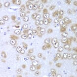 Immunohistochemistry - Anti-RPS10 Antibody (A88633) - Antibodies.com