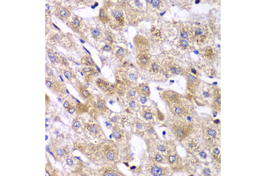 Immunohistochemistry - Anti-RPS10 Antibody (A88633) - Antibodies.com