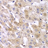Immunohistochemistry - Anti-RPS10 Antibody (A88633) - Antibodies.com