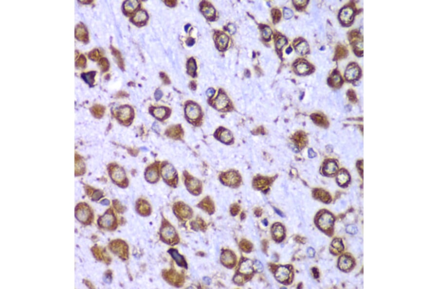 Immunohistochemistry - Anti-RPS10 Antibody (A88633) - Antibodies.com