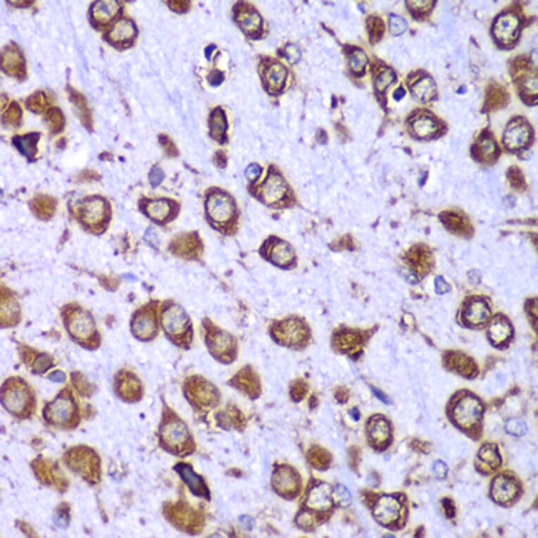 Immunohistochemistry - Anti-RPS10 Antibody (A88633) - Antibodies.com